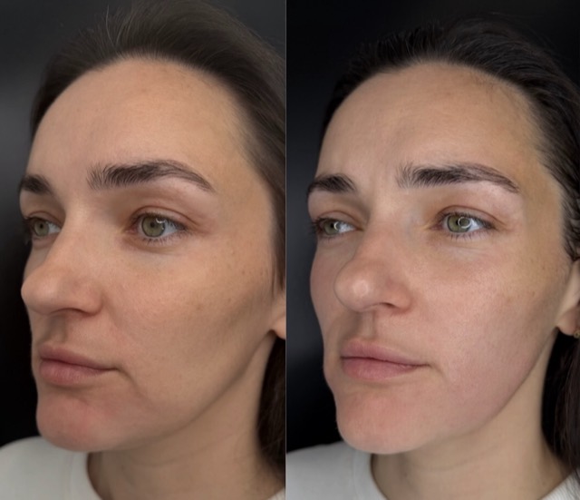 JK Clinic - до и после, VOLNEWMER, Марина Владимировна Крапивина