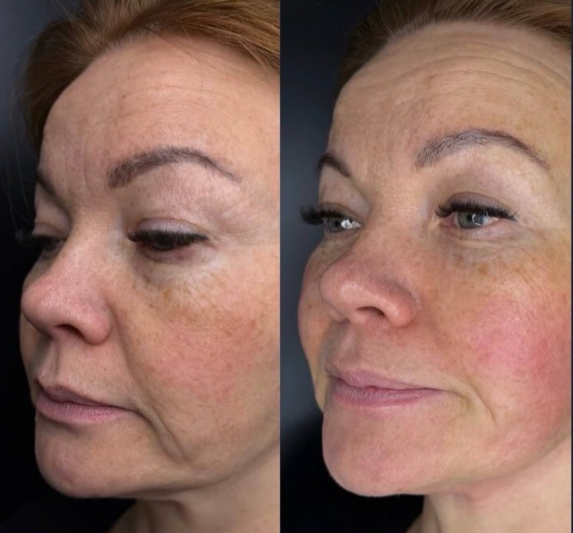 JK Clinic - до и после, VOLNEWMER, Мария Викторовна Титова