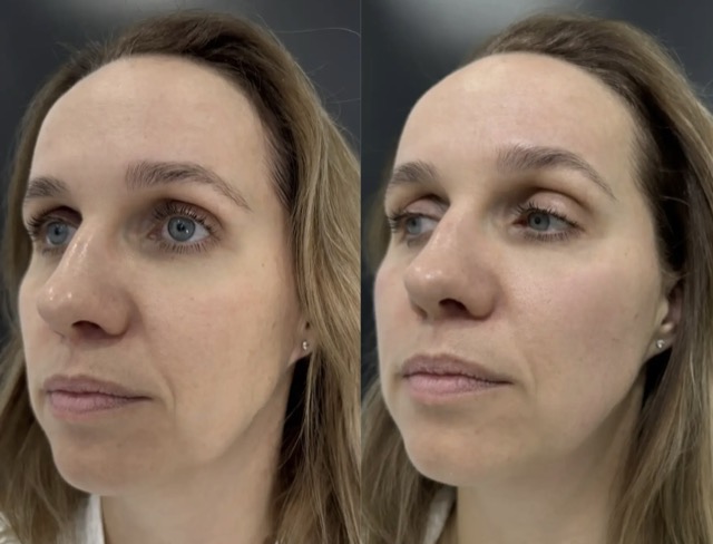 JK Clinic - до и после, VOLFORMER, Мария Викторовна Титова